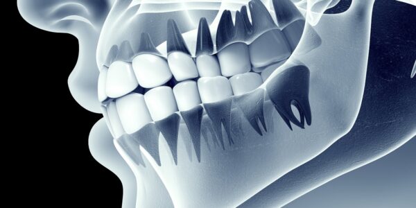 TMJ & TMD Disorder Treatment in New Jersey