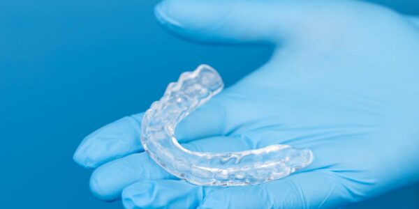 Clear dental night guard resting on a blue medical glove.